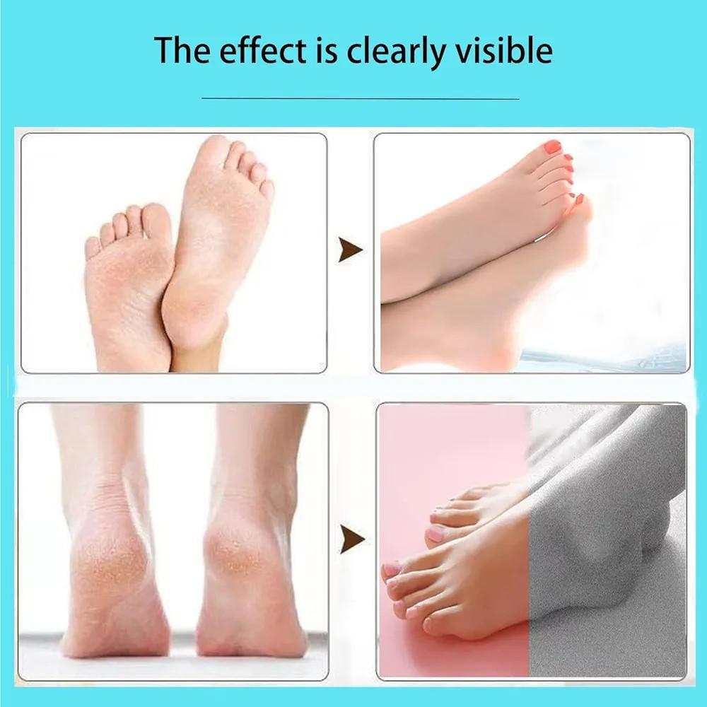 Electric Foot File Callus Remover Pink Rechargeable 2 Pack