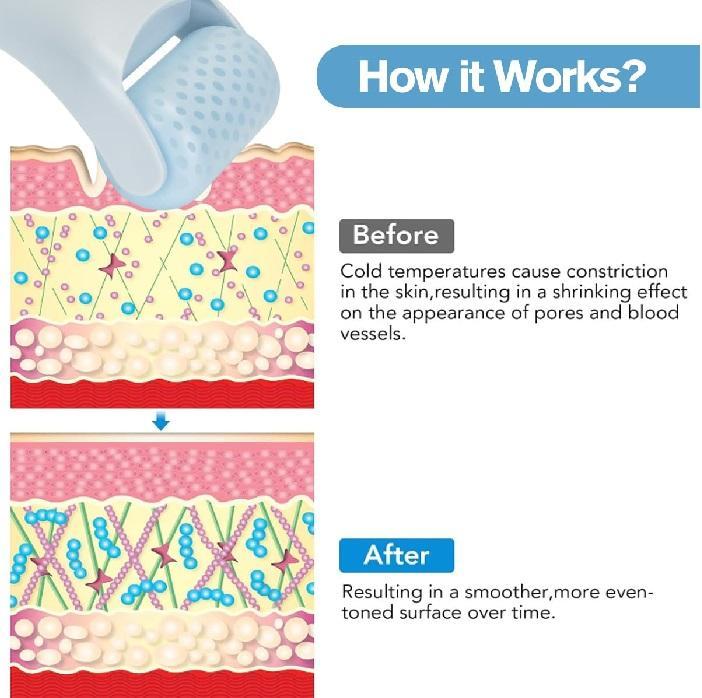 Ice Roller for Hot Pakistani Skin